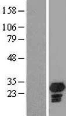 Western Blot: CHMP5 Overexpression Lysate [NBL1-09162]