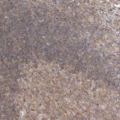 Immunohistochemistry-Paraffin: CHMP6 Antibody [NBP1-83726]