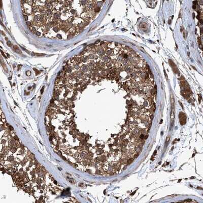 Immunohistochemistry-Paraffin: CHMP6 Antibody [NBP1-83727]