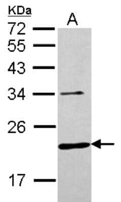 Western Blot: CHMP6 Antibody [NBP2-15889]