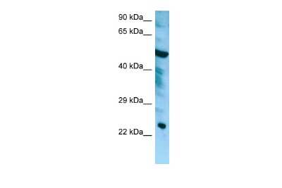 Western Blot: CHMP6 Antibody [NBP2-87186]