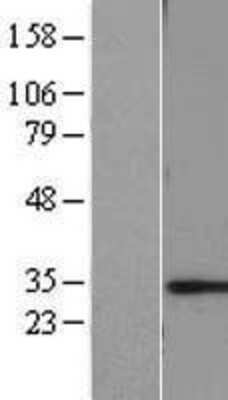 Western Blot: CHMP6 Overexpression Lysate [NBL1-09163]