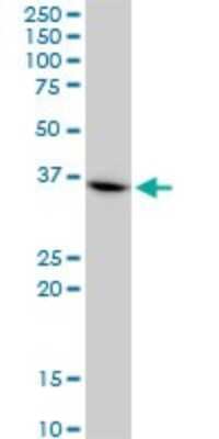 Western Blot: CHN 1 Antibody (3A3) [H00001123-M03]