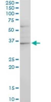 Western Blot: CHN 1 Antibody (3A3) [H00001123-M03]