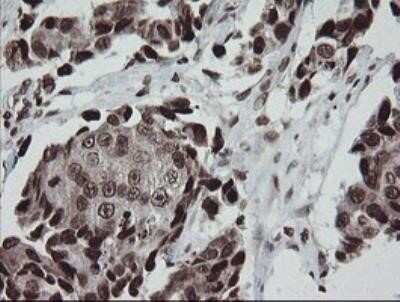 Immunohistochemistry: CHN 1 Antibody (OTI2G6) - Azide and BSA Free [NBP2-70411]