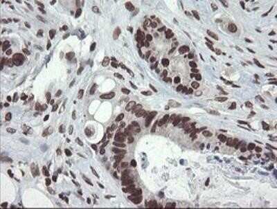 Immunohistochemistry: CHN 1 Antibody (OTI2G6) - Azide and BSA Free [NBP2-70411]