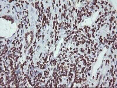 Immunohistochemistry: CHN 1 Antibody (OTI2G6) - Azide and BSA Free [NBP2-70411]