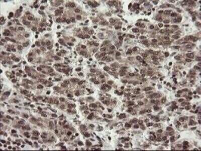 Immunohistochemistry: CHN 1 Antibody (OTI2G6) - Azide and BSA Free [NBP2-70411]