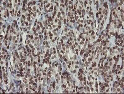 Immunohistochemistry: CHN 1 Antibody (OTI2G6) - Azide and BSA Free [NBP2-70411]