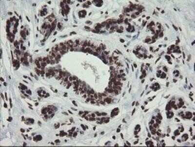 Immunohistochemistry: CHN 1 Antibody (OTI2G6) - Azide and BSA Free [NBP2-70411]