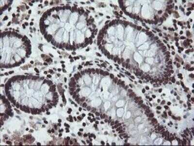 Immunohistochemistry: CHN 1 Antibody (OTI2G6) - Azide and BSA Free [NBP2-70411]