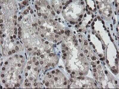 Immunohistochemistry: CHN 1 Antibody (OTI2G6) - Azide and BSA Free [NBP2-70411]