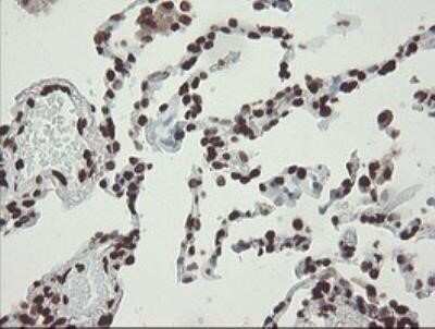 Immunohistochemistry: CHN 1 Antibody (OTI2G6) - Azide and BSA Free [NBP2-70411]