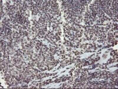 Immunohistochemistry: CHN 1 Antibody (OTI2G6) - Azide and BSA Free [NBP2-70411]