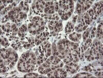 Immunohistochemistry: CHN 1 Antibody (OTI2G6) - Azide and BSA Free [NBP2-70411]