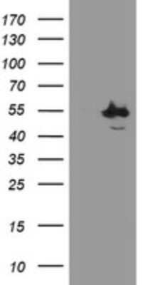 Western Blot: CHN 1 Antibody (OTI2G6)Azide and BSA Free [NBP2-70411]