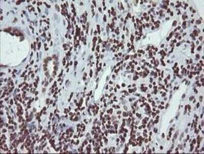 Immunohistochemistry-Paraffin: CHN 1 Antibody (OTI2G6) [NBP2-46290]