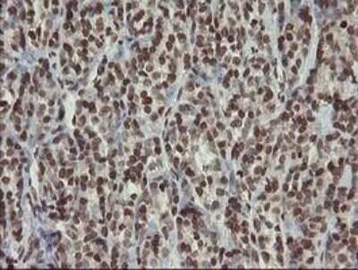 Immunohistochemistry-Paraffin: CHN 1 Antibody (OTI2G6) [NBP2-46290]
