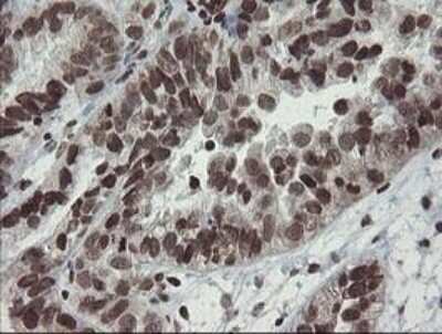Immunohistochemistry-Paraffin: CHN 1 Antibody (OTI2G6) [NBP2-46290]