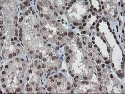 Immunohistochemistry-Paraffin: CHN 1 Antibody (OTI2G6) [NBP2-46290]