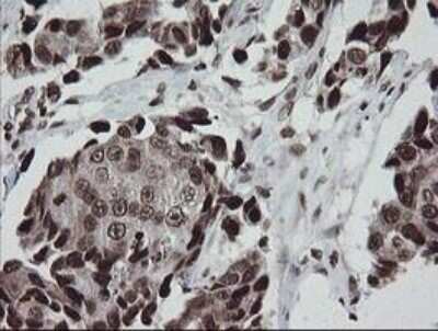 Immunohistochemistry-Paraffin: CHN 1 Antibody (OTI2G6) [NBP2-46290]