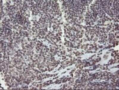Immunohistochemistry-Paraffin: CHN 1 Antibody (OTI2G6) [NBP2-46290]