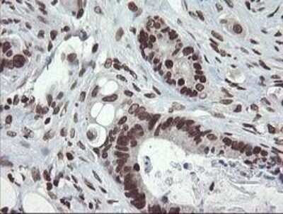 Immunohistochemistry-Paraffin: CHN 1 Antibody (OTI2G6) [NBP2-46290]