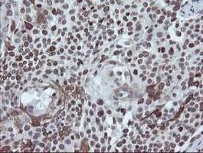Immunohistochemistry-Paraffin: CHN 1 Antibody (OTI2G6) [NBP2-46290]