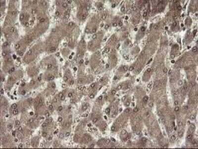 Immunohistochemistry-Paraffin: CHN 1 Antibody (OTI2G6) [NBP2-46290]
