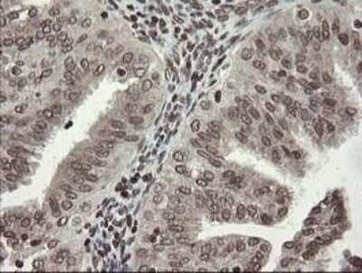 Immunohistochemistry-Paraffin: CHN 1 Antibody (OTI2G6) [NBP2-46290]