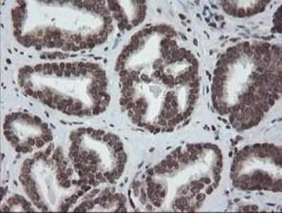 Immunohistochemistry-Paraffin: CHN 1 Antibody (OTI2G6) [NBP2-46290]