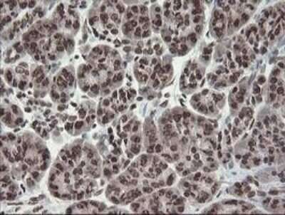Immunohistochemistry-Paraffin: CHN 1 Antibody (OTI2G6) [NBP2-46290]