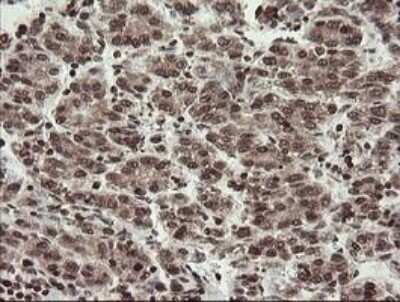 Immunohistochemistry-Paraffin: CHN 1 Antibody (OTI2G6) [NBP2-46290]