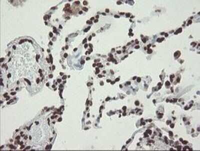 Immunohistochemistry-Paraffin: CHN 1 Antibody (OTI2G6) [NBP2-46290]