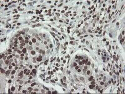 Immunohistochemistry-Paraffin: CHN 1 Antibody (OTI2G6) [NBP2-46290]