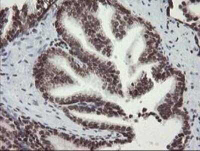 Immunohistochemistry-Paraffin: CHN 1 Antibody (OTI2G6) [NBP2-46290]