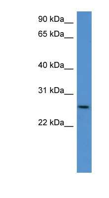 Western Blot: Chondrolectin Antibody [NBP1-79543]