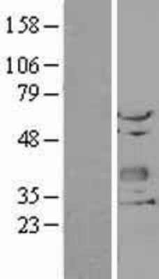 Western Blot: Chondrolectin Overexpression Lysate [NBL1-09167]