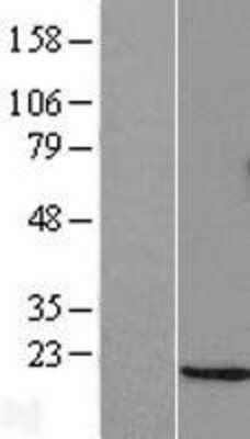 Western Blot: GADD153/CHOP Overexpression Lysate [NBL1-09772]