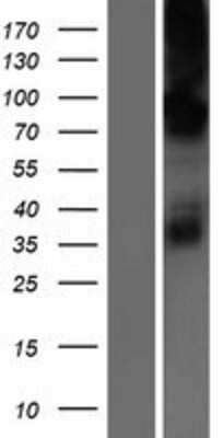 Western Blot: CHPT1 Overexpression Lysate [NBP2-06672]