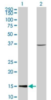 Western Blot: CHRAC1 Antibody (4B8) [H00054108-M05]