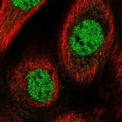 Immunocytochemistry/ Immunofluorescence: CHRAC1 Antibody [NBP2-56768]