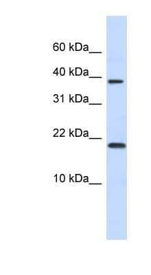 Western Blot: CHRAC1 Antibody [NBP1-80016]