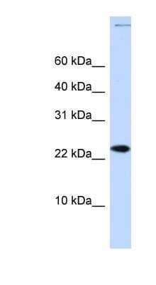 Western Blot: CHRAC1 Antibody [NBP1-80334]