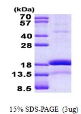 SDS-PAGE: Recombinant Human CHRAC1 His Protein [NBP2-22779]