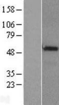 Western Blot: Chordin-like 1/CHRDL1 Overexpression Lysate [NBL1-09171]