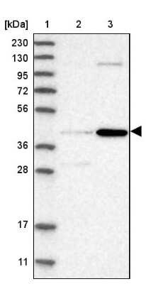 Western Blot: Chordin-like 2/CHRDL2 Antibody [NBP1-88560]