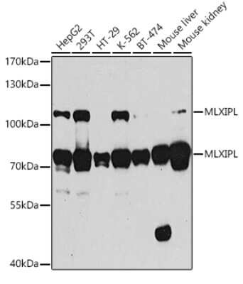 Western Blot: CHREBP AntibodyBSA Free [NBP2-92977]