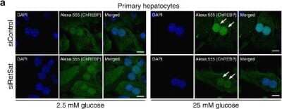 Immunocytochemistry/ Immunofluorescence: CHREBP Antibody - BSA Free [NB400-135]