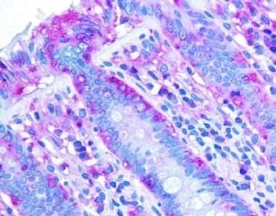 Immunohistochemistry-Paraffin: CHREBP Antibody - BSA Free [NB400-135]